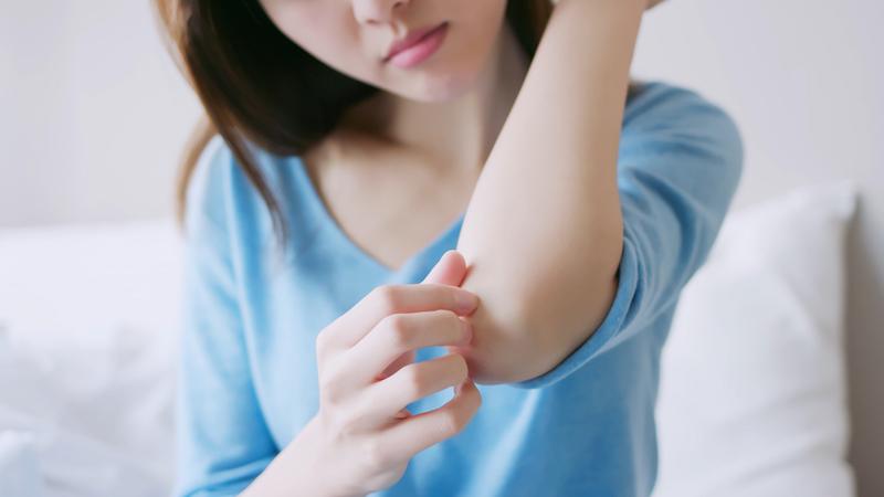 A woman with psoriosis scraches her elbow.