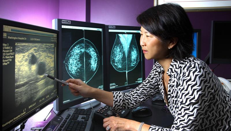 Anna Choi_Radiology_Breast Cancer Scans_MWHC_Washington_Breast_Care