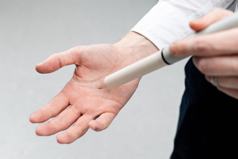 A magseed marker, about the size of a grain of rice, on a human hand 