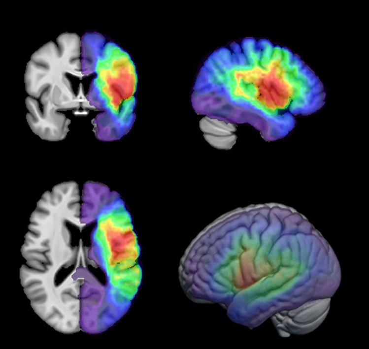 Photo of diagnostic imaging scans of a human brain