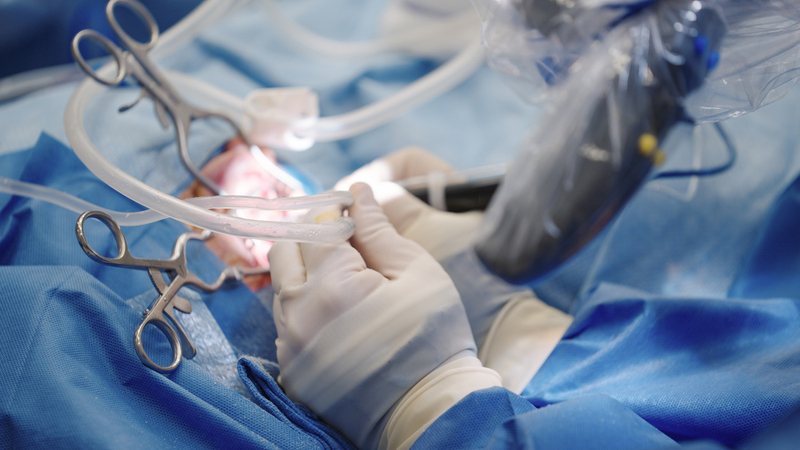 Dr. Michael Hoa performs surgery to implant a new cochlear implant at MedStar Health.