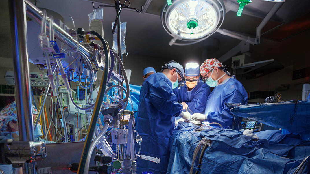 Dr Keki Balsara performs a surgical heart procedure with a team at MedStar Health.