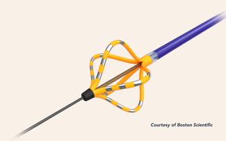 Illustration of a Farapulse Pulsed Field Ablation catheter