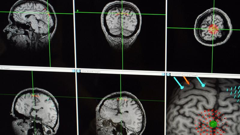 Diagnostic imaging of the brain.