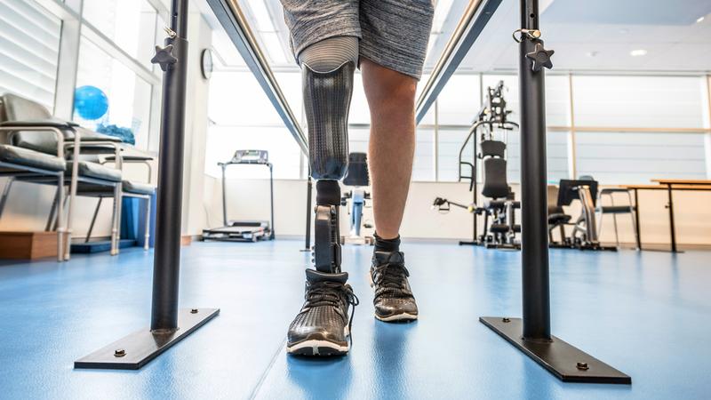 Close up photo of a man's prosthetic leg as he is walking with the assistance of parallel bars in a rehabilitation gym.