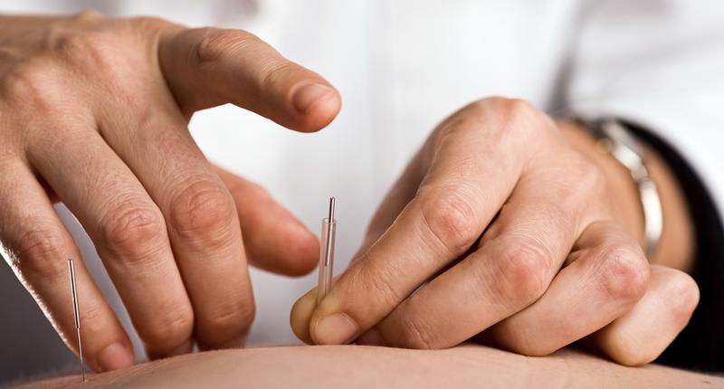 Close up photo of a practitioner placing acupuncture needles on a patient.