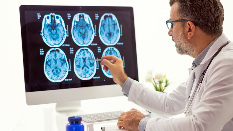 A doctor looks at brain scans on a computer screen.