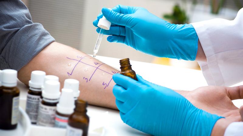 Close up photo of a patient undergoing an allergy test.