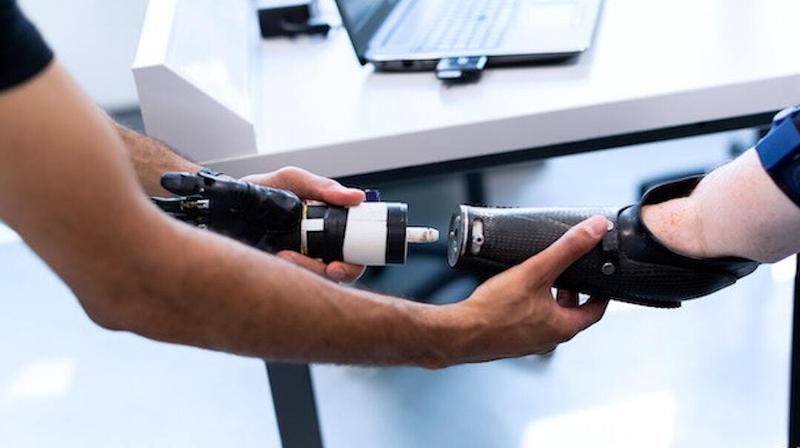 Close up photo of a patient being fitted for a robotic arm and hand.