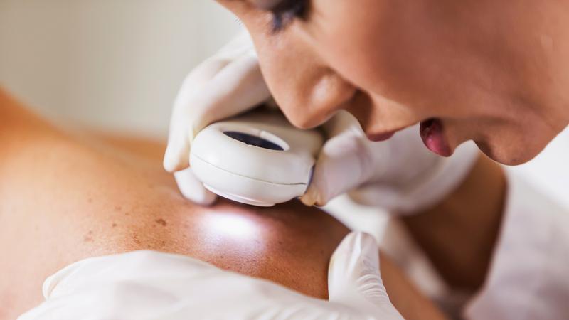 A dermatologist uses a magnifying tool to look closely at a patient's skin.