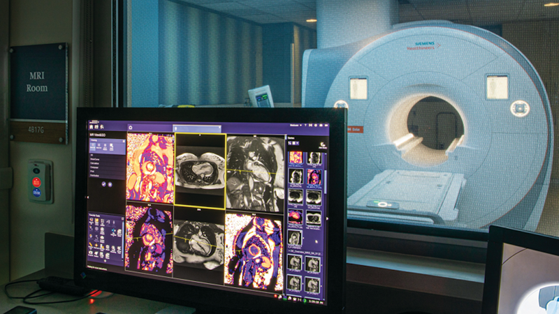Photo of an MRI machine at MedStar Heart and Vascular Institute..