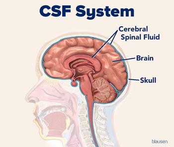 Medical illustration showing the location of cerebrospinal fluid in the brain.
