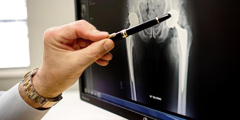 Close up photo of a hand holding a pen that is pointing to a hip xray on a computer screen.