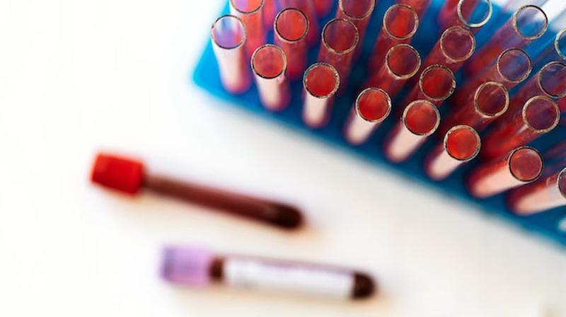 Photo of test tubes in a rack taken from a high angle.