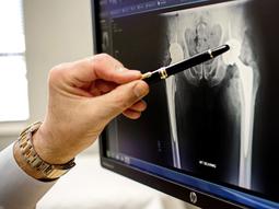 封闭手拿着笔在计算机屏幕上指向髋关节X射线的笔的照片。