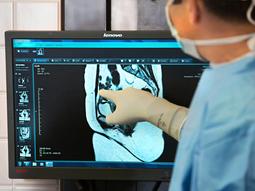 A doctor points to a scan on a computer screen showing a radiology scan.