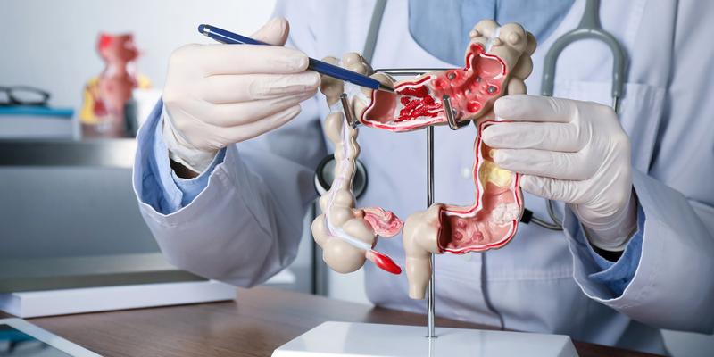 A gastroenterologist points to a model of a human colon.