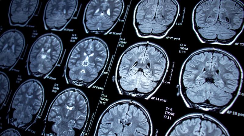 Multimodal Brain Growth Patterns: Insights from Canonical