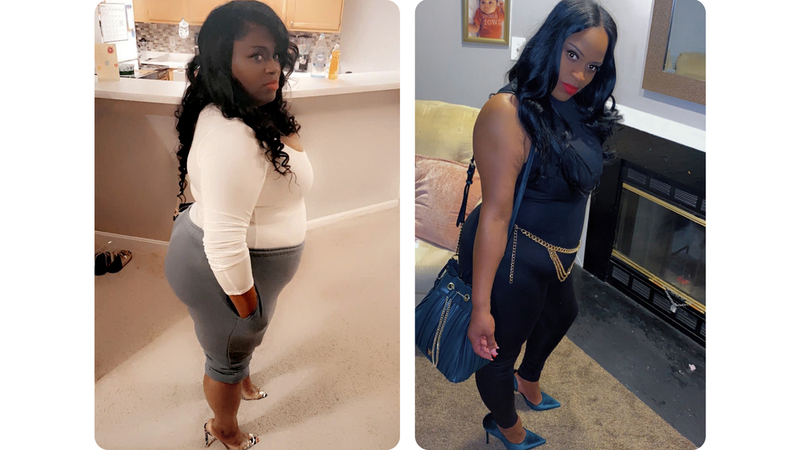 Rachele underwent successful bariatric surgery at MedStar Health.