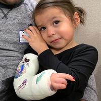 Julianna underwent successful surgery at the Curtis National Hand Center at MedStar Union Memorial Hospital.