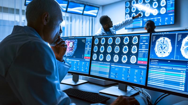 A male physician looks at a row of computer screens showing MRI brain scans.