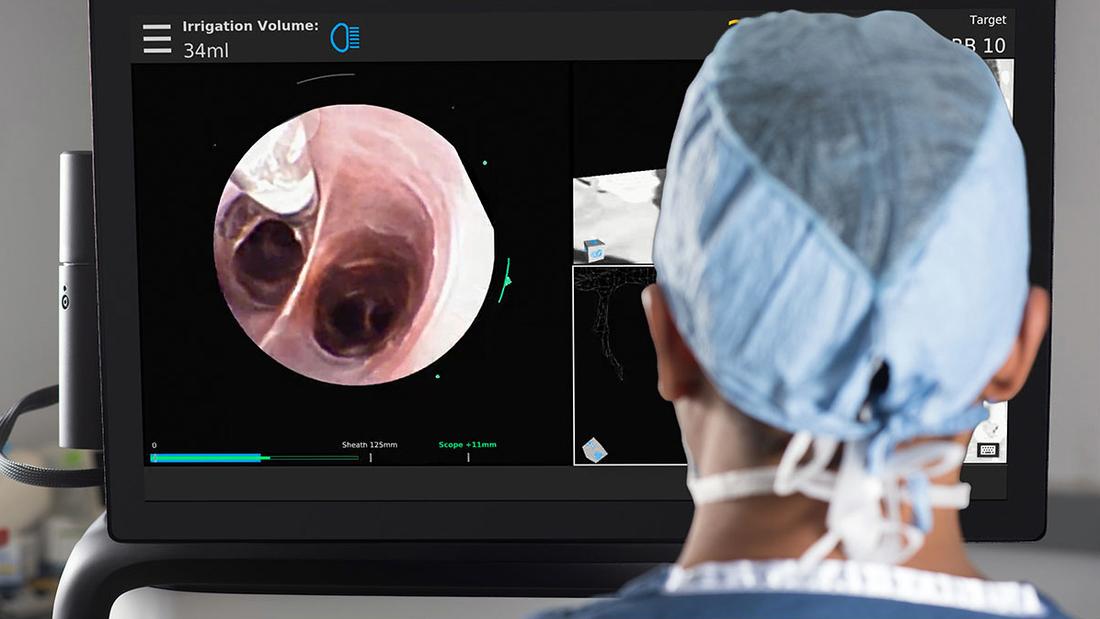 A physician sits in front of a monitor screen for the Monarch Platform robotic diagnostic machine at MedStar Washington Hospital Center.