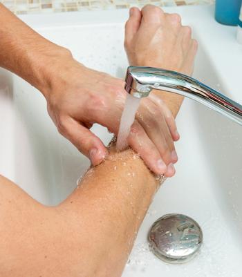 Close up photo of a person putting cold water on their arm under a faucet.