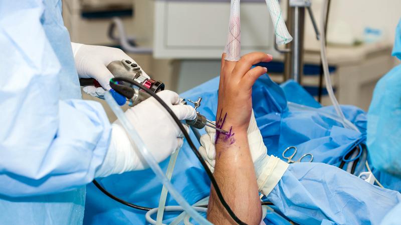 A team performs arthroscopic surgery in an operating room.