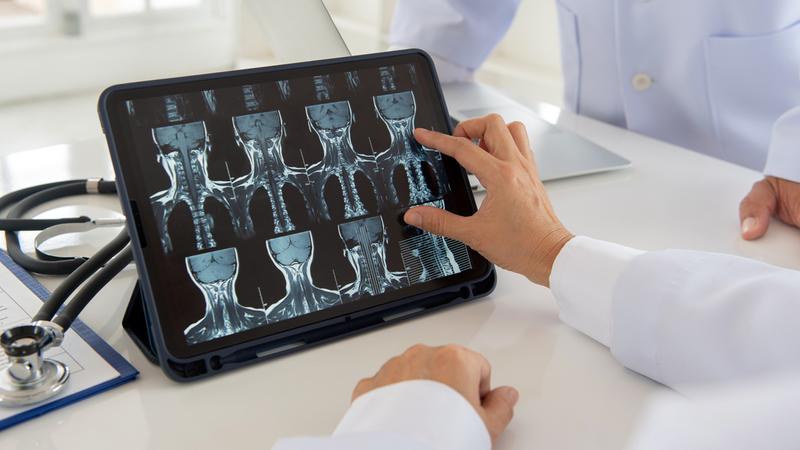 Doctors look at scans of a patient's neck on an ipad.