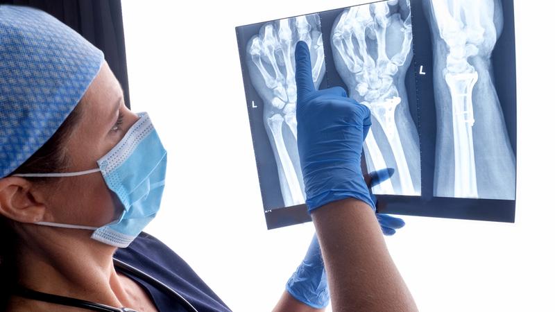 A doctor looks at xray scans of a patient's hand and wrist.