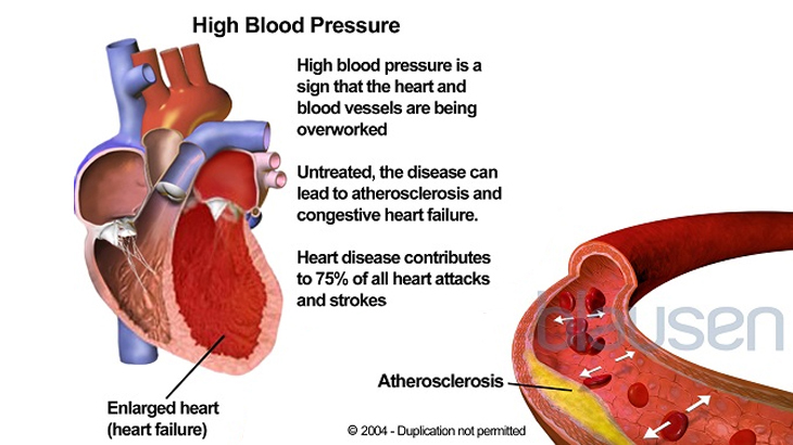 Medical illustration of the heart