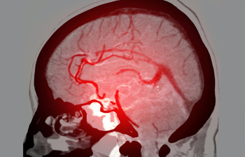 Scan showing vascular system in the brain.