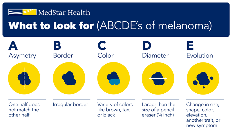 Skin Cancer signs and symptoms infographic