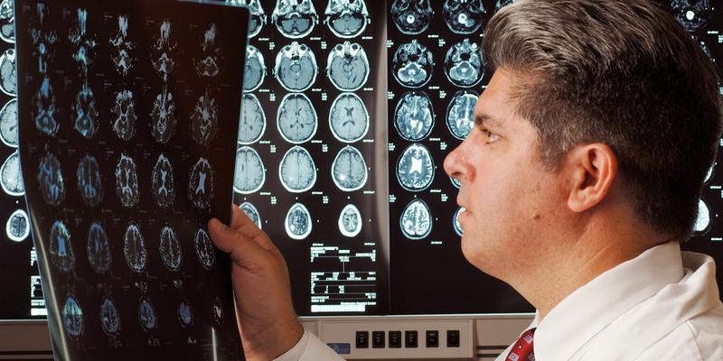 Dr Aulisi looks at diagnostic imaging scans of the brain.