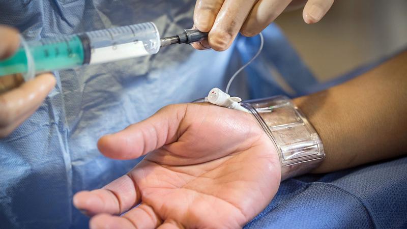 Close up photo of a patient's wrist undergoing a  transradial catheterization procedure.