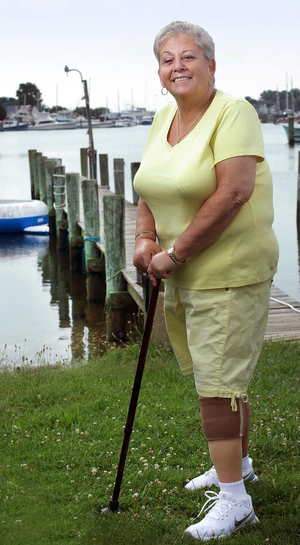 June Shepherd stands outside in front of a pier on the water, with the support of a cane, after a recent amputation.