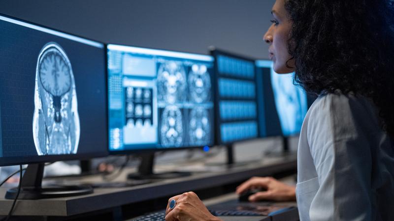 A female physician looks at a row of computer screens showing MRI brain scans.