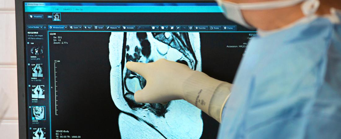 A doctor points to a scan on a computer screen showing a radiology scan.